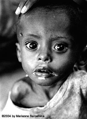 Starving child